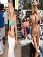 Heidi Montag Before and After Plastic Surgery