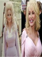 Dolly Parton Before and After Plastic Surgery