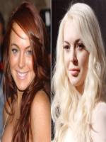 Lindsay Lohan Before and After Plastic Surgery