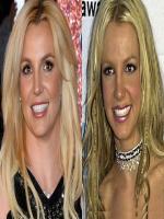 Britney Spears before and after surgery
