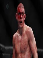 Joe Lauzon in Action