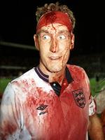 Terry Butcher Injured