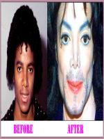 Michael Jackson after plastic surgery