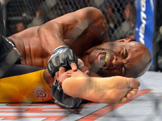 Anderson Silva Injured Leg Pictures