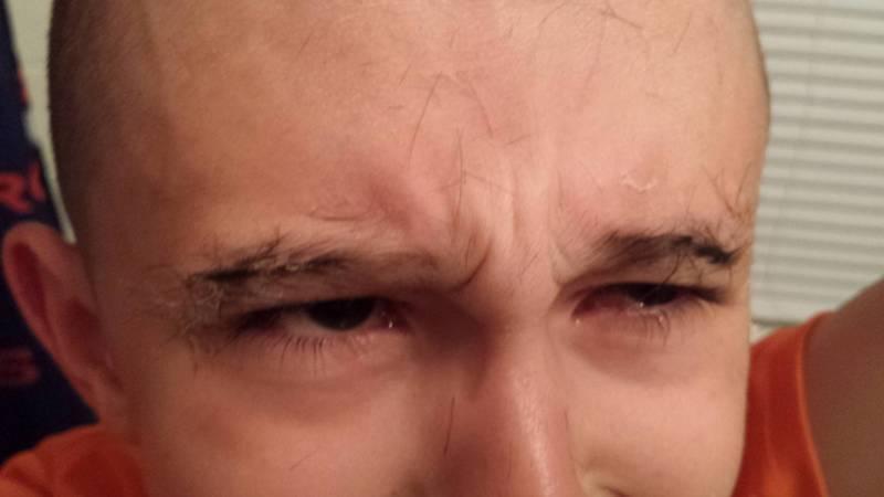 My kid decided to trim his eyebrows. When he cut them too short he dec